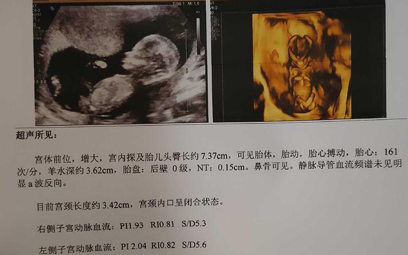 武汉三代供卵试管双胞胎-武汉三代供卵试管双胞胎：科技助力生育的奇迹